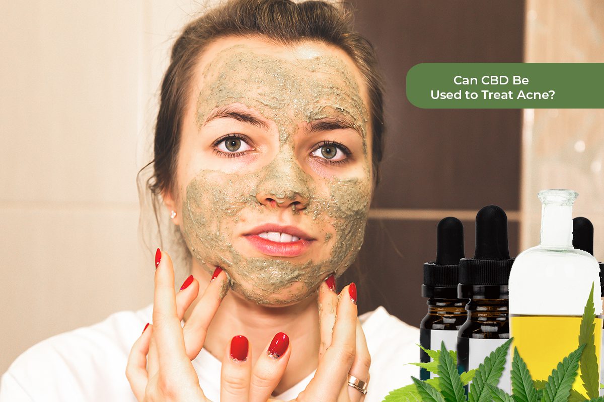 CBD for Acne