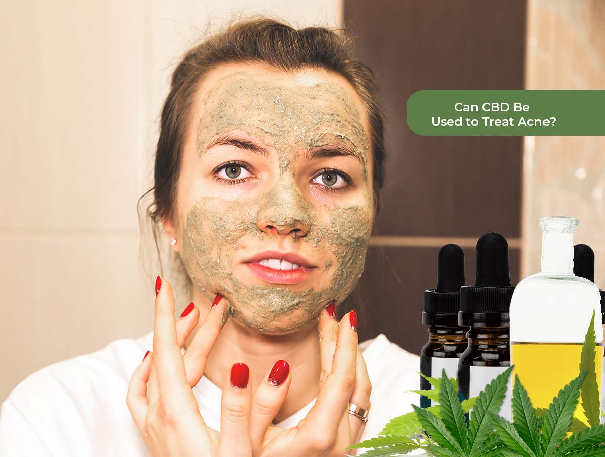 CBD for Acne